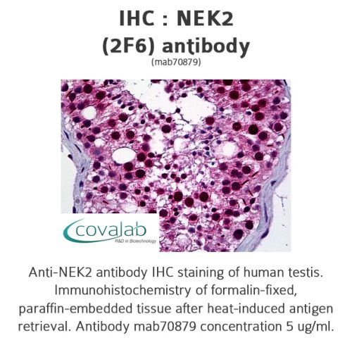 NEK2 (2F6) antibody