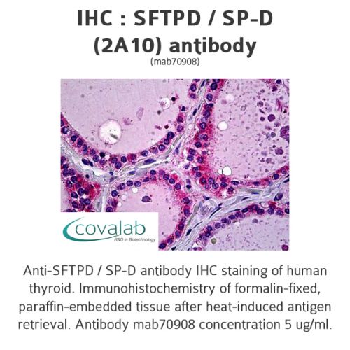 SFTPD / SP-D (2A10) antibody