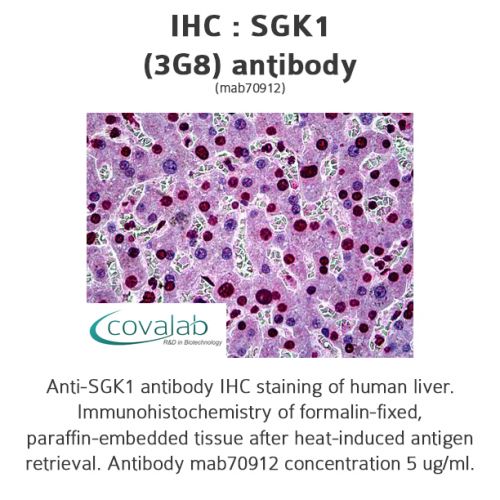SGK1 (3G8) antibody