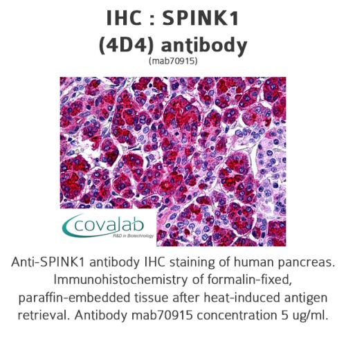 SPINK1 (4D4) antibody