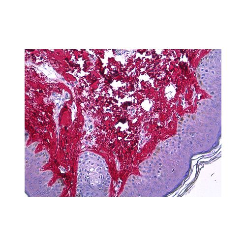 COL1A1 (3G3) antibody