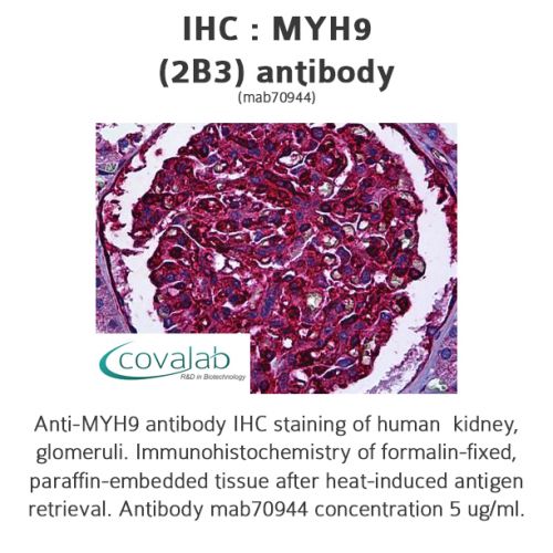 MYH9 (2B3) antibody