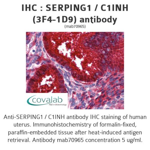 SERPING1 / C1INH (3F4-1D9) antibody