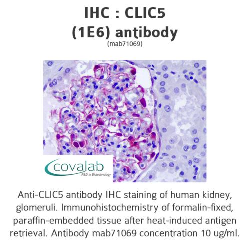 CLIC5 (1E6) antibody