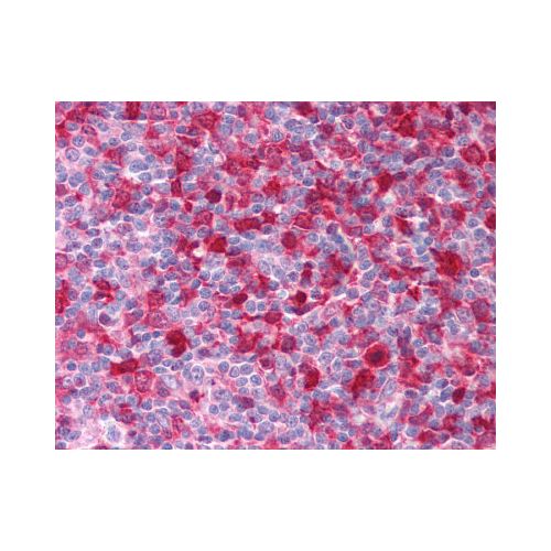 SYK (aa5-360) (SYK-01) antibody
