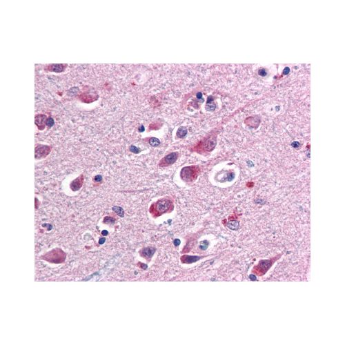 SARM1 / SARM (Sarmy-1 ) antibody