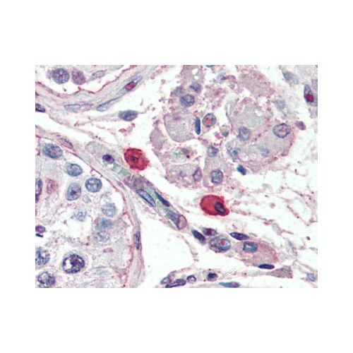 Fc Epsilon Receptor 1 (9E1) antibody