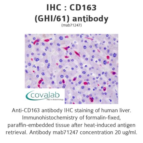 CD163 (GHI/61) antibody