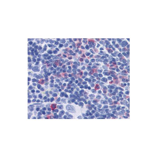 IL-17 (TC11-18H10) antibody