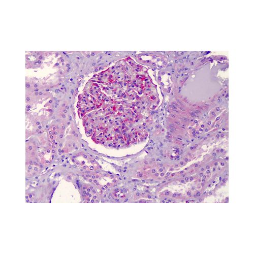 NLRP3 (Nalpy3-b ) antibody