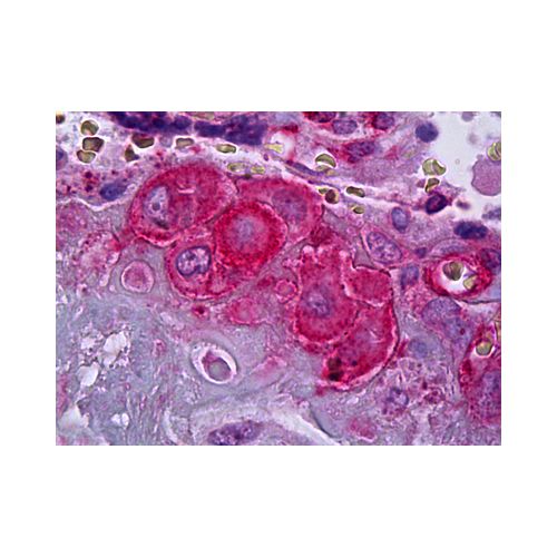SERPINE1 / PAI-1 antibody