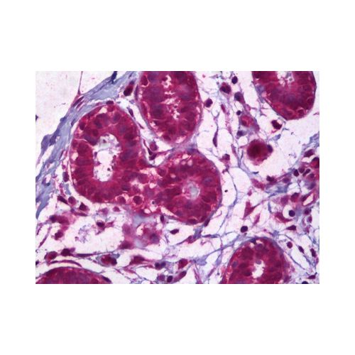 IL-8 antibody