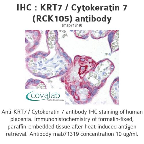 KRT7 / Cytokeratin 7 (RCK105) antibody