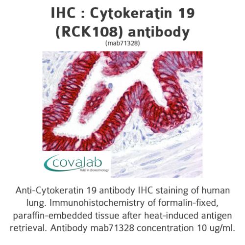 Cytokeratin 19 (RCK108) antibody