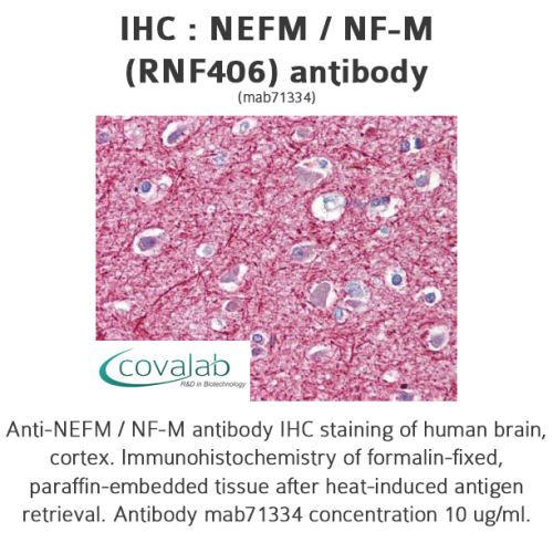 NEFM / NF-M (RNF406) antibody