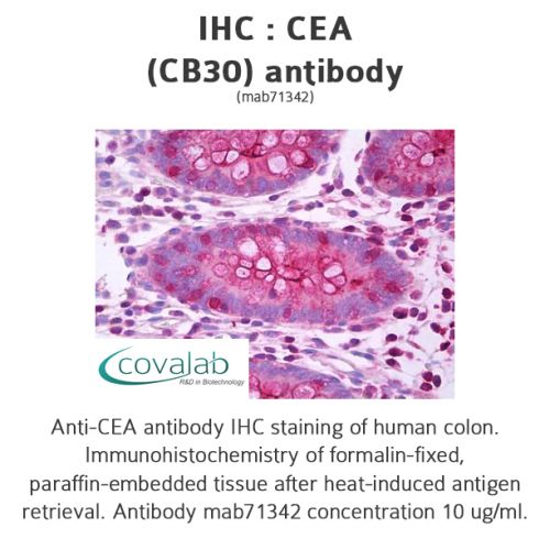 CEA (CB30) antibody