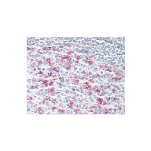 IHC - PD1 (J116) antibody<br/>(mab71365)<br/>Anti-PD-1 antibody IHC of human tonsil. Immunohistochemistry of formalin-fixed, paraffin-embedded tissue after heat-induced antigen retrieval. Antibody dilution 20 µg/ml.
