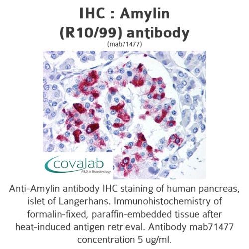 Amylin  (R10/99) antibody