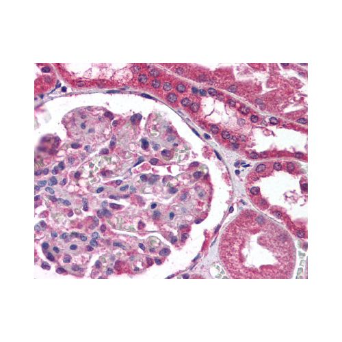 COL18A1 / Endostatin antibody