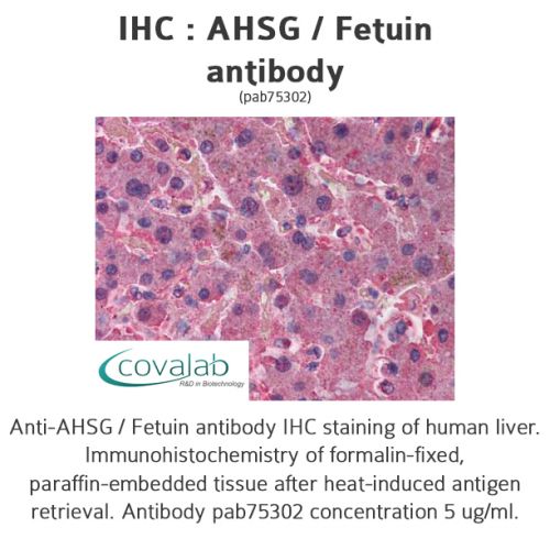 AHSG / Fetuin antibody