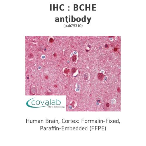 BCHE antibody