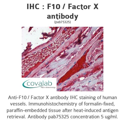 F10 / Factor X antibody