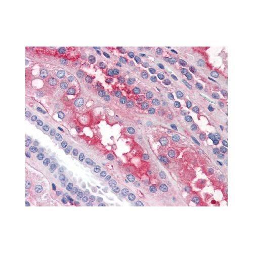 F12 / Factor XII antibody