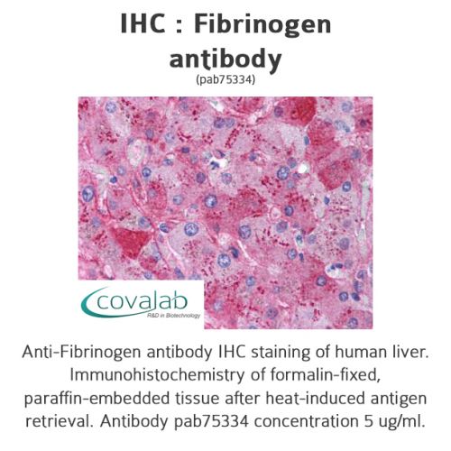 Fibrinogen antibody