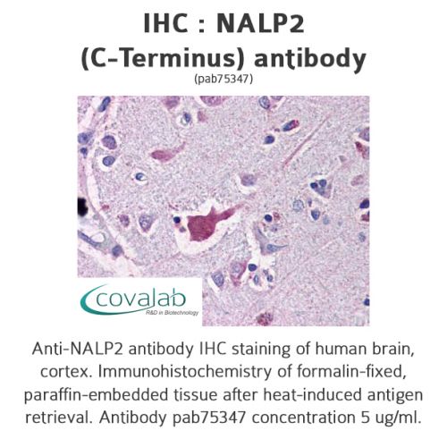 NALP2 (C-Terminus) antibody