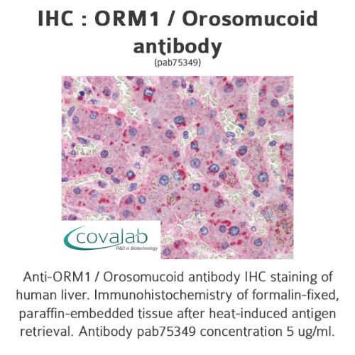 ORM1 / Orosomucoid antibody