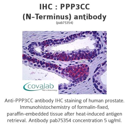 PPP3CC (N-Terminus) antibody