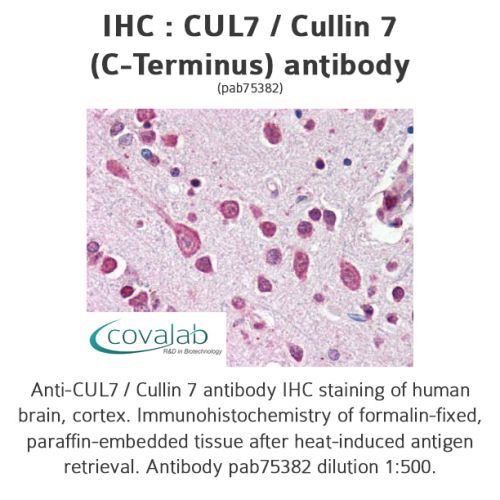 CUL7 / Cullin 7 (C-Terminus) antibody