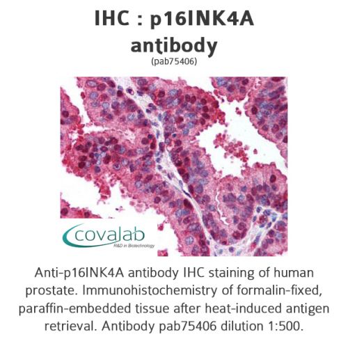 p16INK4A antibody