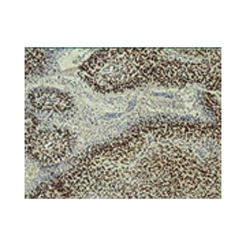 HIF-1 beta antibody (H1beta234)