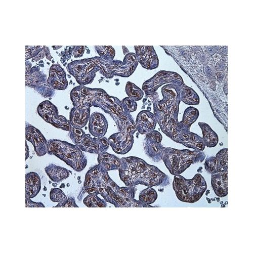 Hypoxia inducible factor-1 alpha antibody (ESEE122)