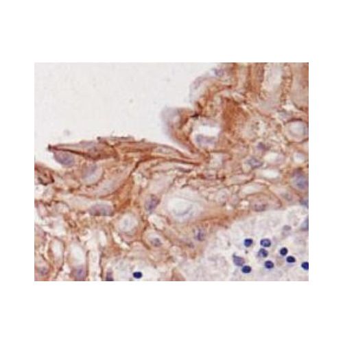 Desmoglein-3 antibody (5G11)