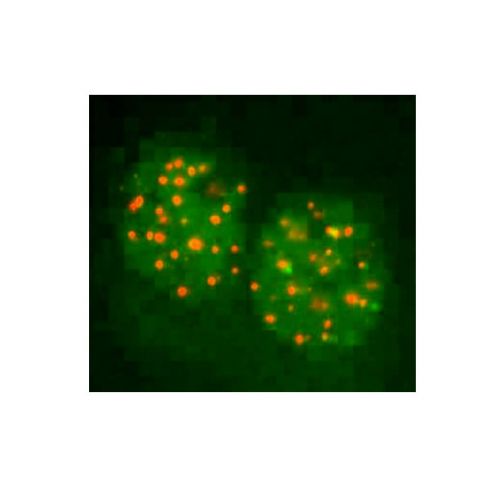 Fanconi anemia D2 (FANCD2) antibody