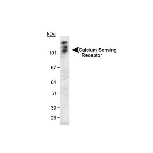 Extracellular calcium-sensing receptor (CaSR) antibody
