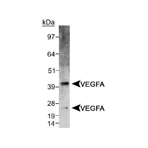 Vascular endothelial growth factor A (VEGFA) antibody