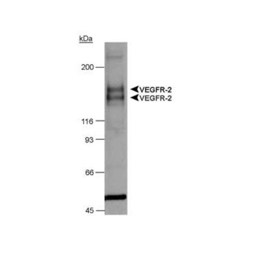 Vascular endothelial growth factor receptor 1 (VEGFR1) antibody