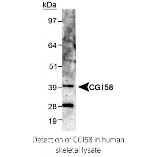 ABHD5 antibody