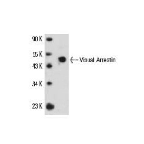 S-arrestin antibody (PDS-1)