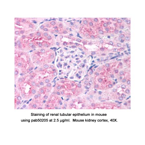 Hypoxia-inducible factor prolyl hydroxylase 2 antibody