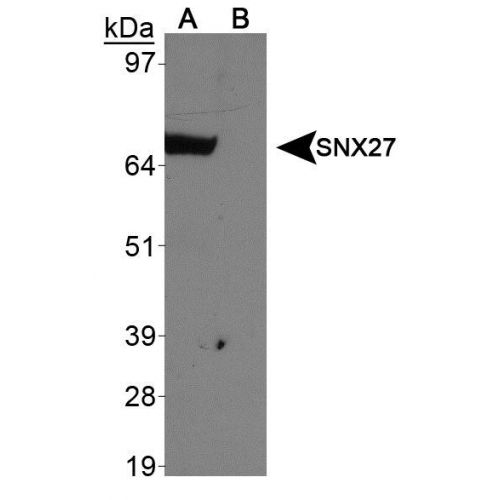 SNX27 antibody