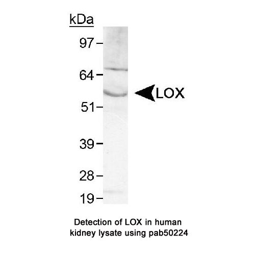 Lysyl oxidase (LOX) antibody