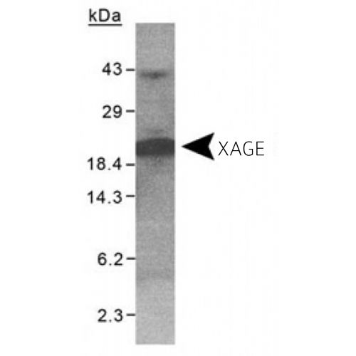 X antigen family, member 1 (XAGE1) antibody
