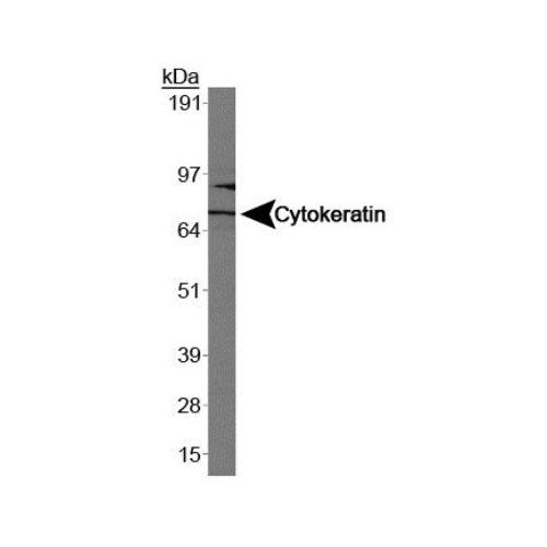 Cytokeratin-1 antibody