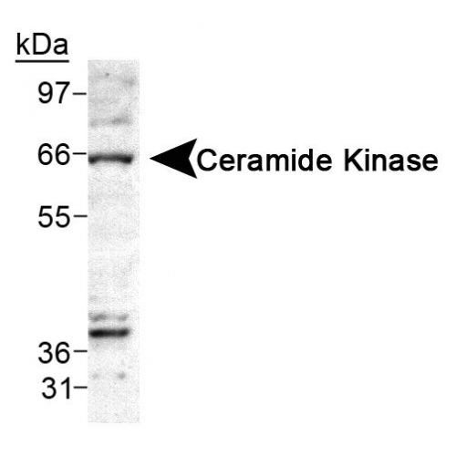 Ceramide Kinase antibody