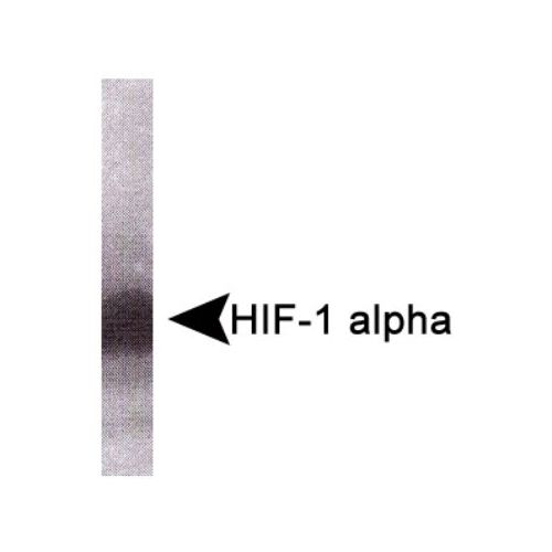 Hypoxia inducible factor-1 alpha antibody (HA111)