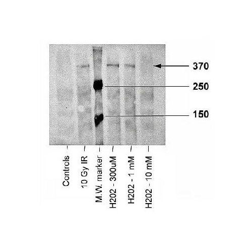 ATM Kinase [p Ser1981] antibody (10H11.E12)